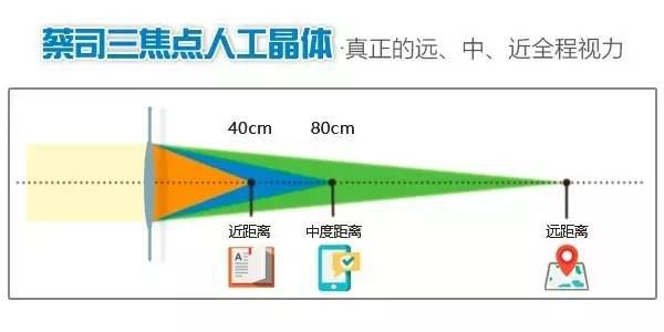 屈光性晶體手術(shù)新進(jìn)展暨老視門診成立新聞發(fā)布會順利召開